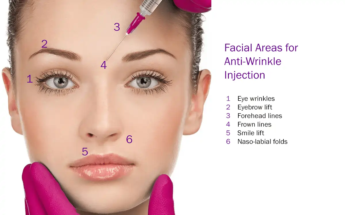 Botox-Wrinkles