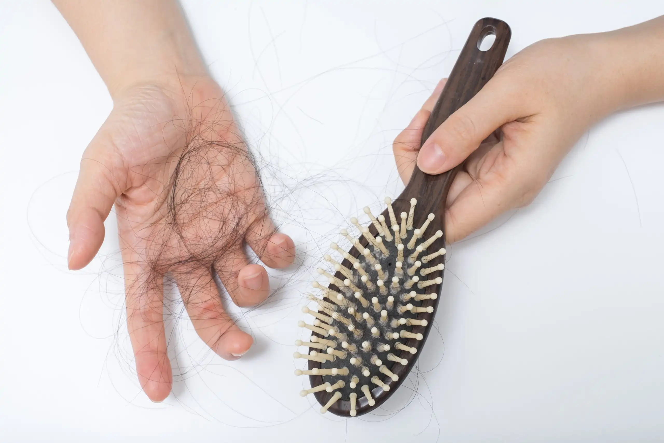 Hairfall